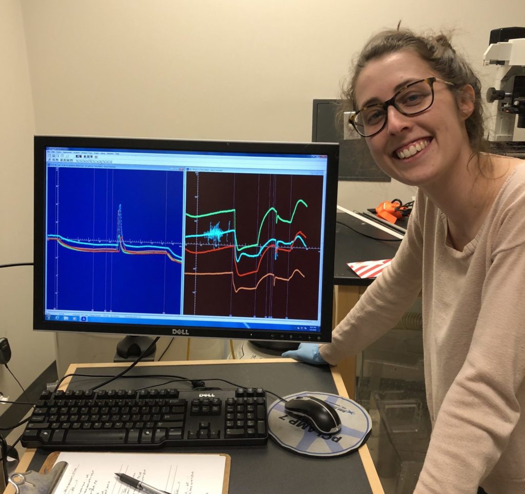 Dr. Kirsten (Brown) Cottrill is shown with digital analysis of her research studying bronchial epithelial cells in Cystic Fibrosis patients.