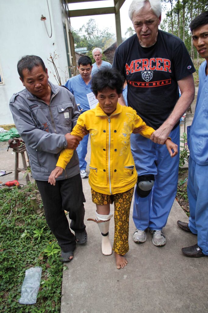 two men help a woman with a prosthesis walk