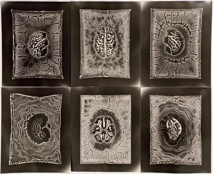 Six black and white brains scans.