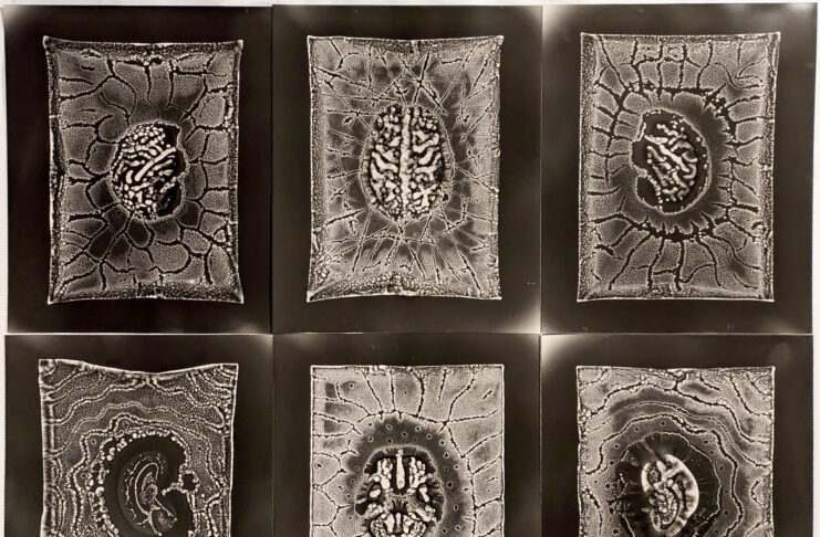 Six black and white brains scans.