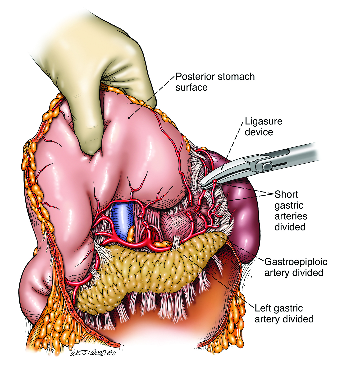 Mercer alumnus played role advancing medical illustration field