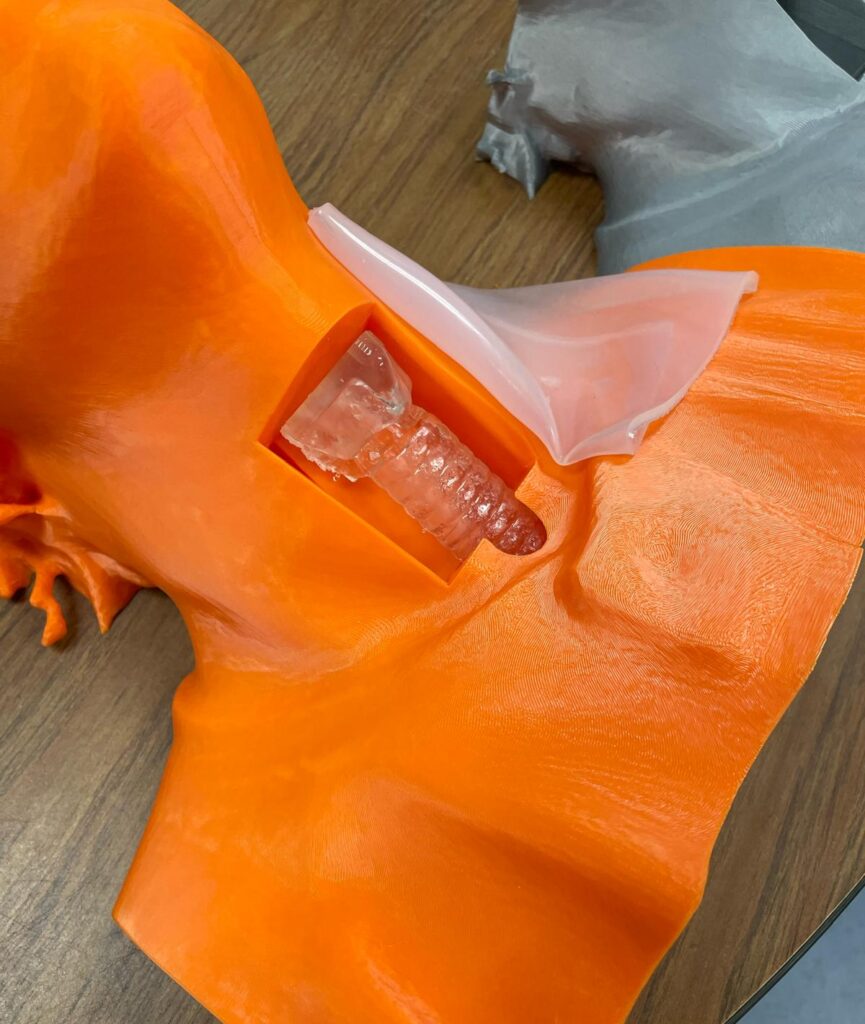 A 3D-printed anatomical model with a transparent insert showing an internal screw implant on a wooden surface.